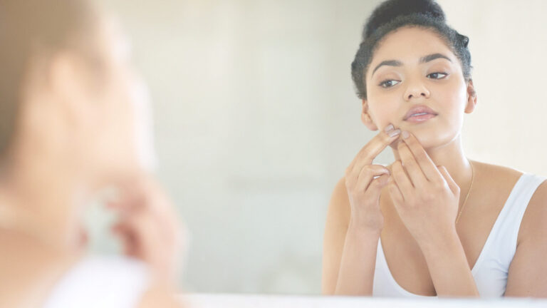 Zdravie365.sk - Akné Face Mapping: Ako zistiť príčinu vzniku vášho akné